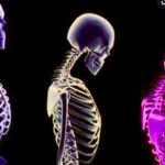 Osteoporoz nasıl engellenir?